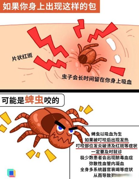 梦到被吸血虫咬_意味着什么
