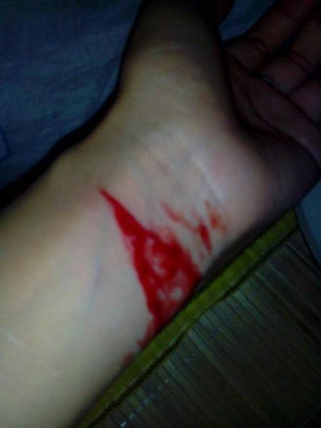 梦到手腕被割破流血_意味着什么