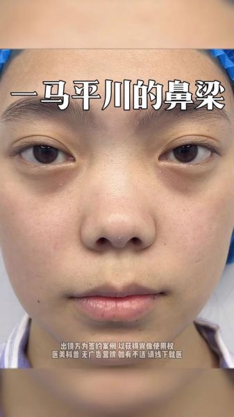 塌鼻财运差怎么办_塌鼻真的影响财运吗