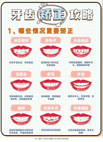 龅牙会影响财运吗_如何化解