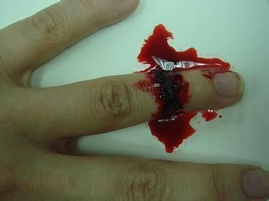 梦到被刀划伤_是什么意思