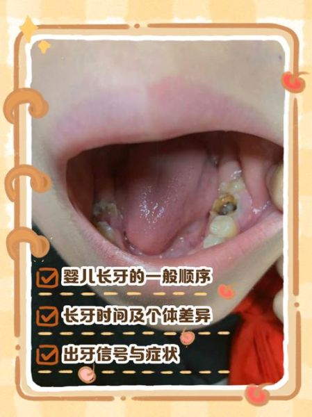 做梦梦到长牙是什么意思_梦见长牙预示什么