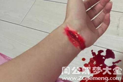 梦到儿子受伤流血_是什么预兆