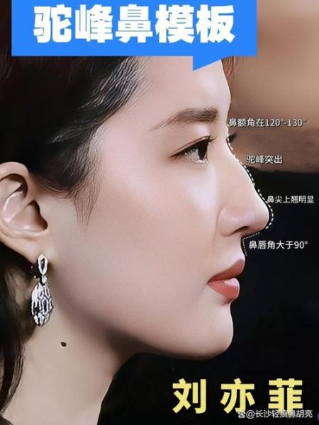 鹰钩鼻女人财运好吗_鹰钩鼻女人面相与财富关系