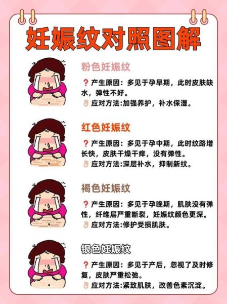 梦到妊娠纹_意味着什么