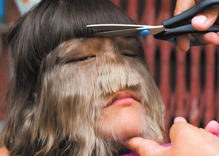 梦见脸上长毛怎么回事_脸上长毛梦境解析