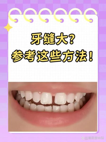 梦到牙缝大是什么意思_梦到牙缝大怎么办