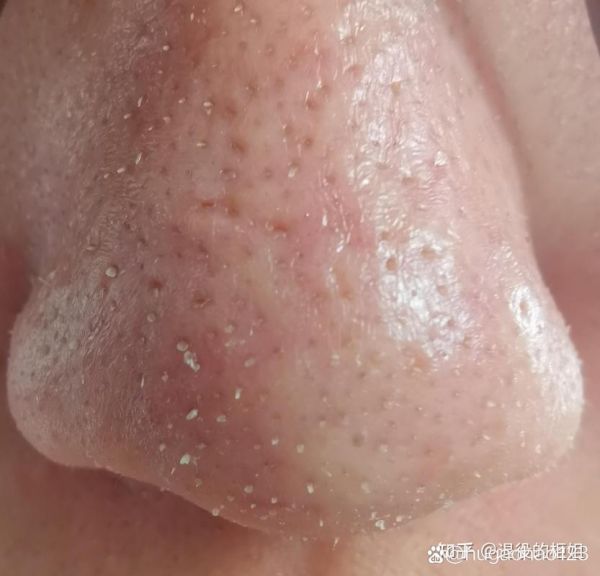 梦到不干净的东西_怎么办