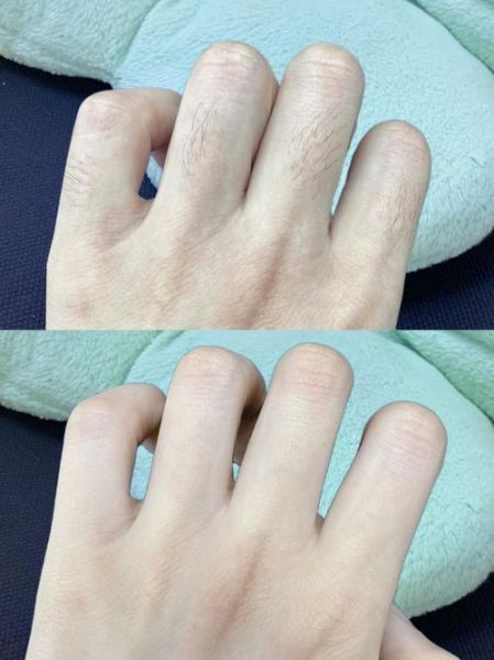 梦到手上长毛_是什么预兆