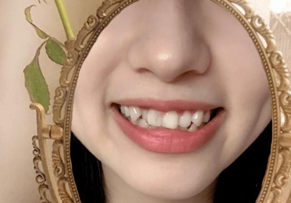 女人牙齿不齐财运好不_牙齿不齐影响运势吗