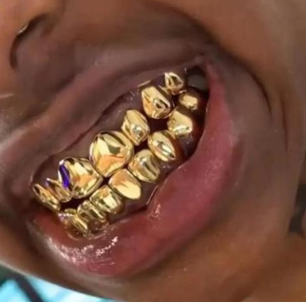 梦到装假牙是什么意思_梦到装假牙预示什么