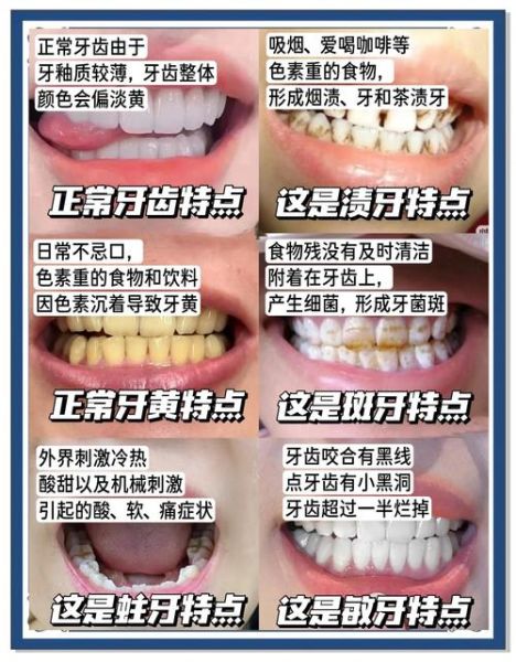 梦到牙齿黄是什么意思_牙齿变黄预示什么
