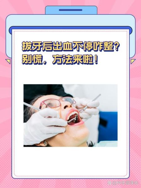 拔牙会影响财运吗_拔牙后如何转运