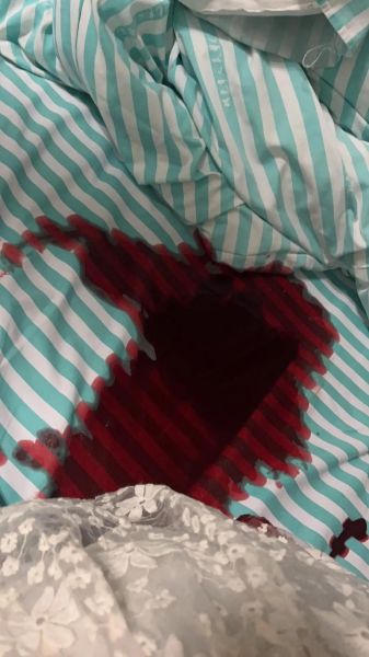 梦到大出血是什么意思_梦到大出血预示着什么